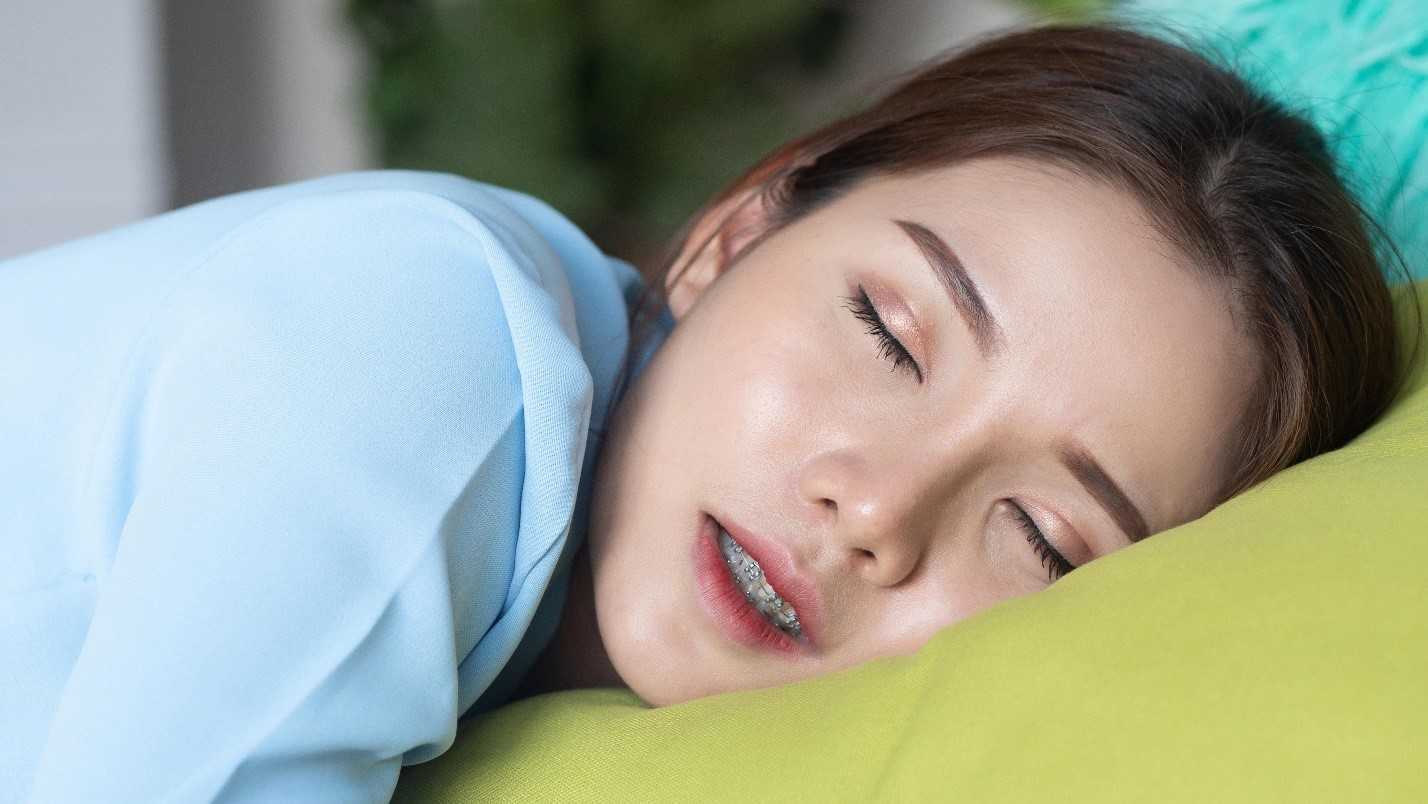 Woman Sleeps While Wearing Orthodontic Wax On Braces